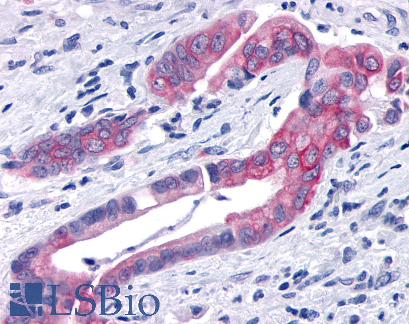 PathPlus™ TNIK Antibody (Internal)