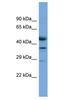 ETFB Antibody (aa145-194)