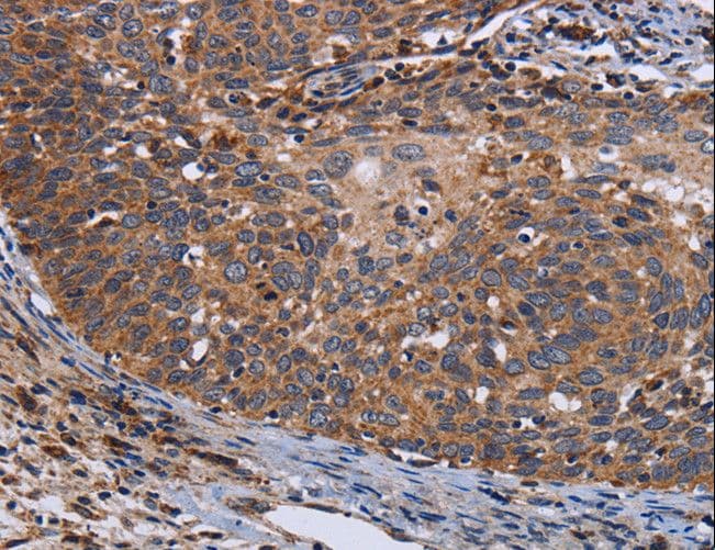 Polyclonal Rabbit anti-Human LRRC15 Antibody (IHC)