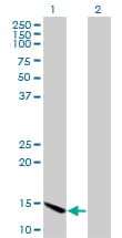 Monoclonal Mouse anti-Human CHRAC1 Antibody (clone 4E7, WB)