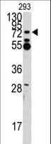 Polyclonal Rabbit anti-Human ZFP219 / ZNF219 Antibody (aa154-183, IHC, WB)