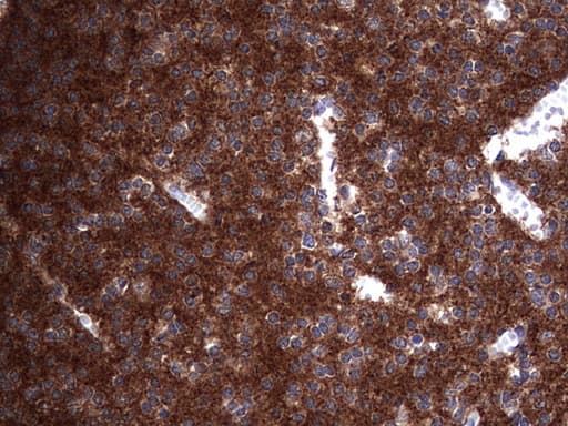 NUMB Antibody (aa1-365, clone OTI1B5)
