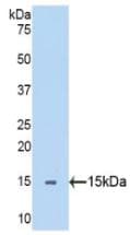 SEMA5B / Semaphorin 5B Antibody (aa36-161)