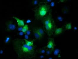 MAPRE2 / EB2 Antibody (clone OTI4G1)