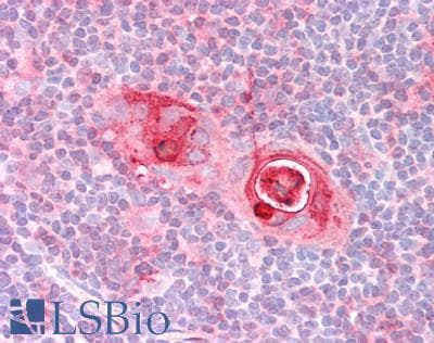 Polyclonal Rabbit anti-Human FOXN1 Antibody (IHC, WB)