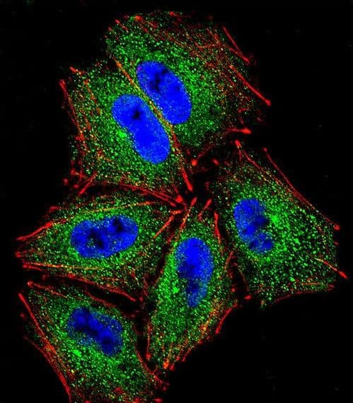 Polyclonal Rabbit anti-Human PCDHAC2 Antibody (aa616-644, IHC, IF, WB)