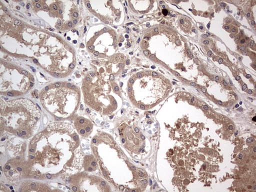 Monoclonal Mouse anti-Human SMPD1 / Acid Sphingomyelinase Antibody (clone OTI3H7, aa62-341, IHC, WB)