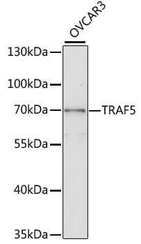 Polyclonal Rabbit anti-Human TRAF5 Antibody (WB)