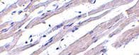 APAF1 / APAF-1 Antibody (aa12-28)