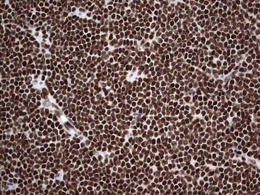 HNRNPL / hnRNP L Antibody (aa270-502, clone OTI2E4)