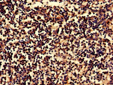 BLNK Antibody