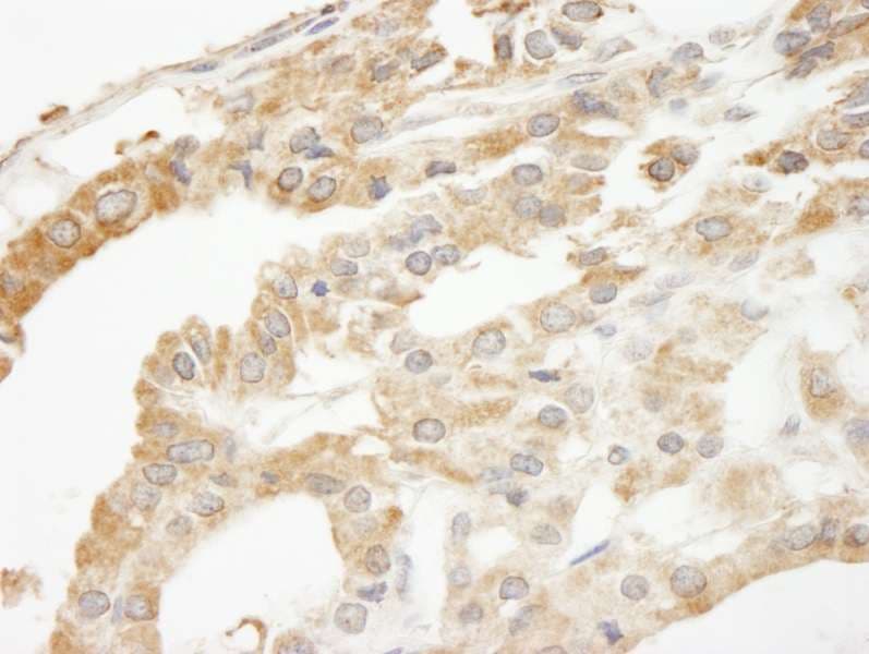 Polyclonal Rabbit anti-Human ABCF2 Antibody (aa573-623, IHC)