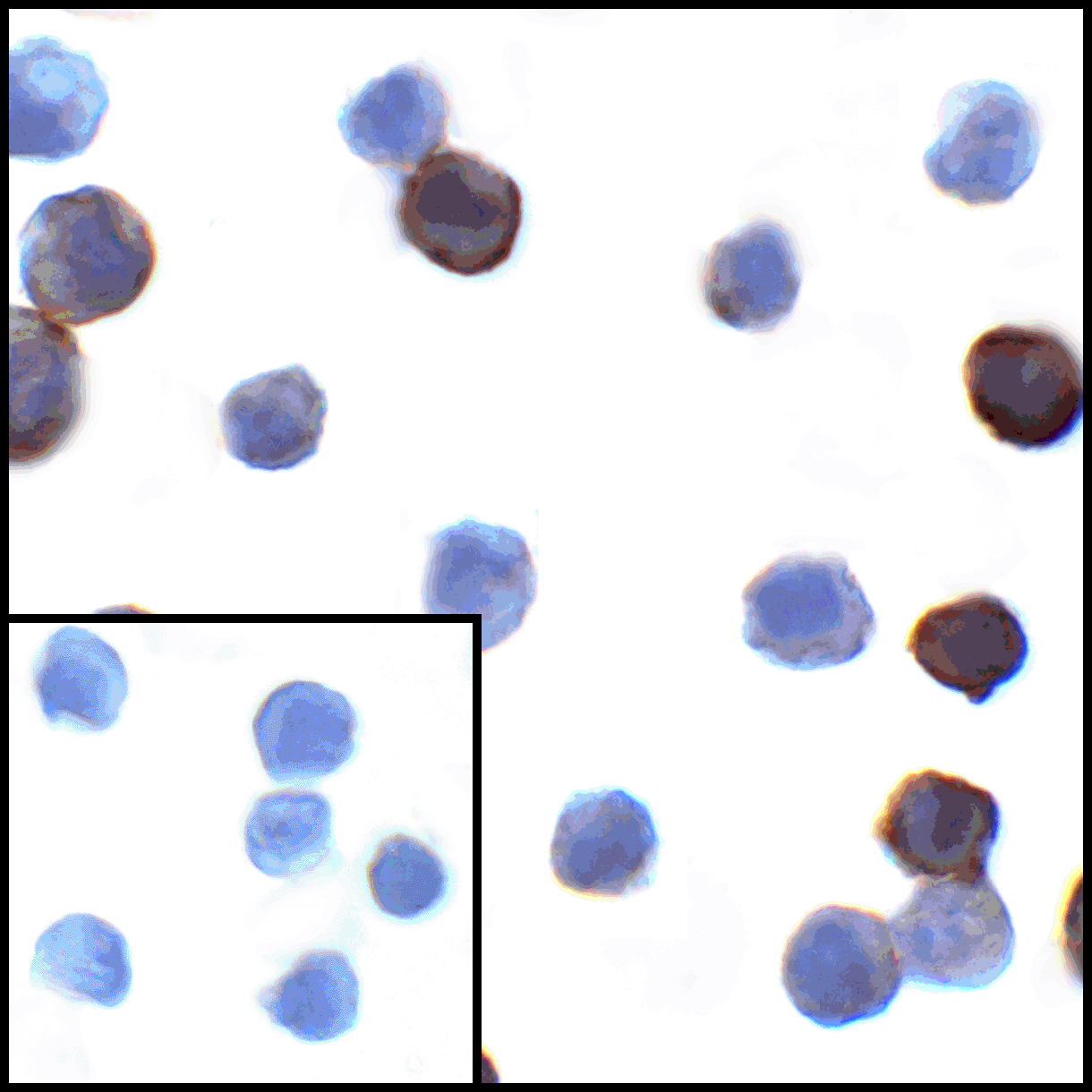 CD274 / B7-H1 / PD-L1 Antibody (clone 6H10)