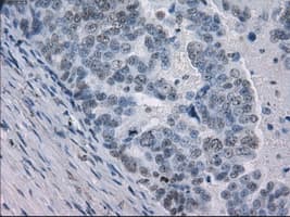 Monoclonal Mouse anti-Human GBP2 Antibody (clone OTI1E5, IHC, IF, WB)