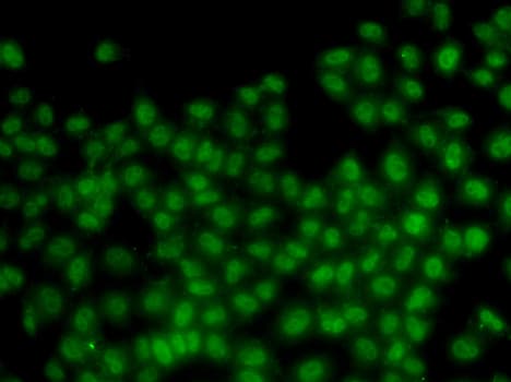 Polyclonal Rabbit anti-Human ID3 Antibody (IHC, IF, WB)