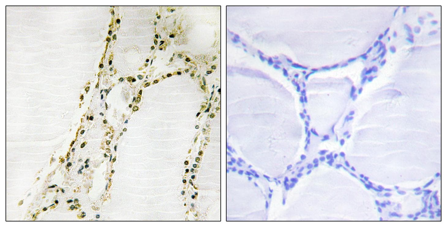 RPS6KA2 / RSK3 Antibody