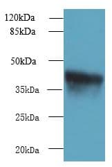 Polyclonal Rabbit anti-Human ZDHHC4 Antibody (IHC, WB)