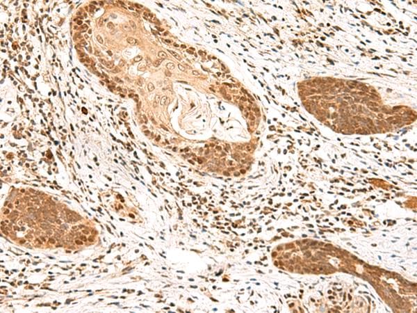 MKX Antibody