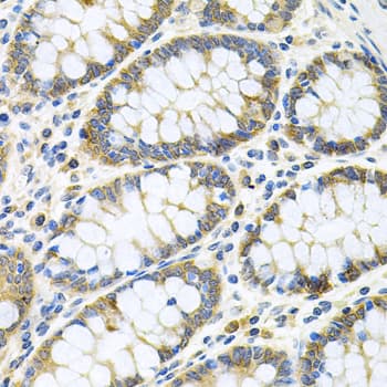 GLCNE / GNE Antibody