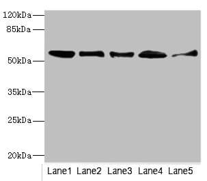 GLYCTK / Glycerate Kinase Antibody