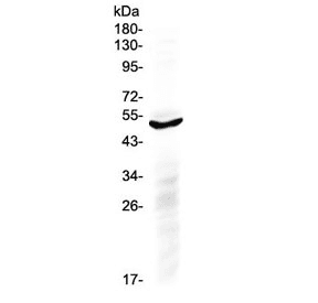 Polyclonal Rabbit anti-Human IL6R / IL6 Receptor Antibody (WB)