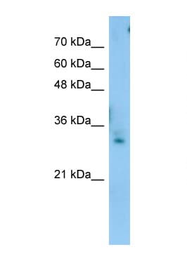 Polyclonal Rabbit anti-Human TEX264 Antibody (C-Terminus, WB)