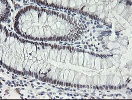TLE1 / TLE 1 Antibody (clone OTI1D6)