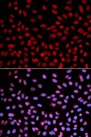 POLH / DNA Polymerase Eta Antibody