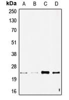 SCG10 / STMN2 Antibody (Internal)