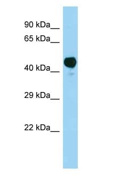 AACS Antibody (aa257-306)