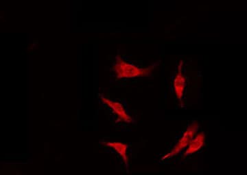 FAM117B / ALS2CR13 Antibody