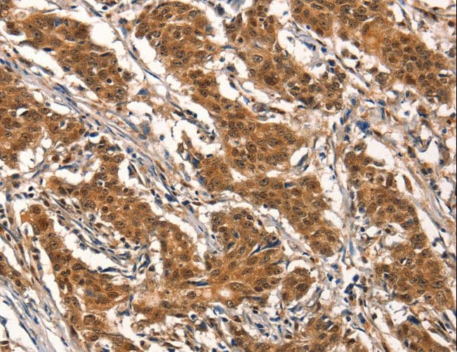 CYP2B6 Antibody