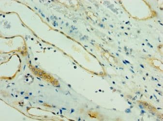 PARL / PSARL Antibody (aa1-170)