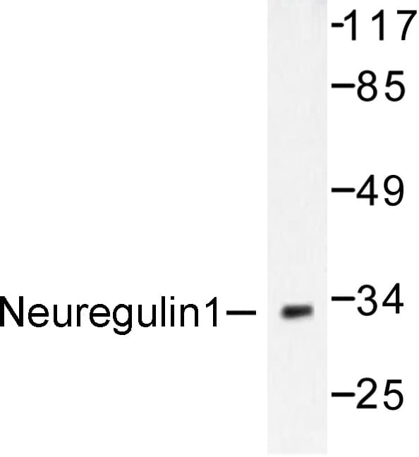 NRG1 / Heregulin / Neuregulin Antibody (Tyr4)