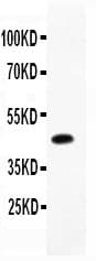 CD79B / CD79 Beta Antibody (aa29-229)