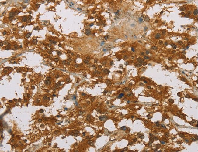 CYP39A1 Antibody