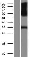 FGFR1 / FGF Receptor 1 Protein (Over-Expression Lysate Myc-DDK (Flag))