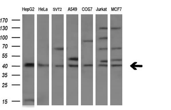 TNFRSF10B / Killer / DR5 Antibody (aa203-411, clone OTI2A5)