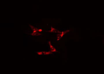 TOLLIP Antibody