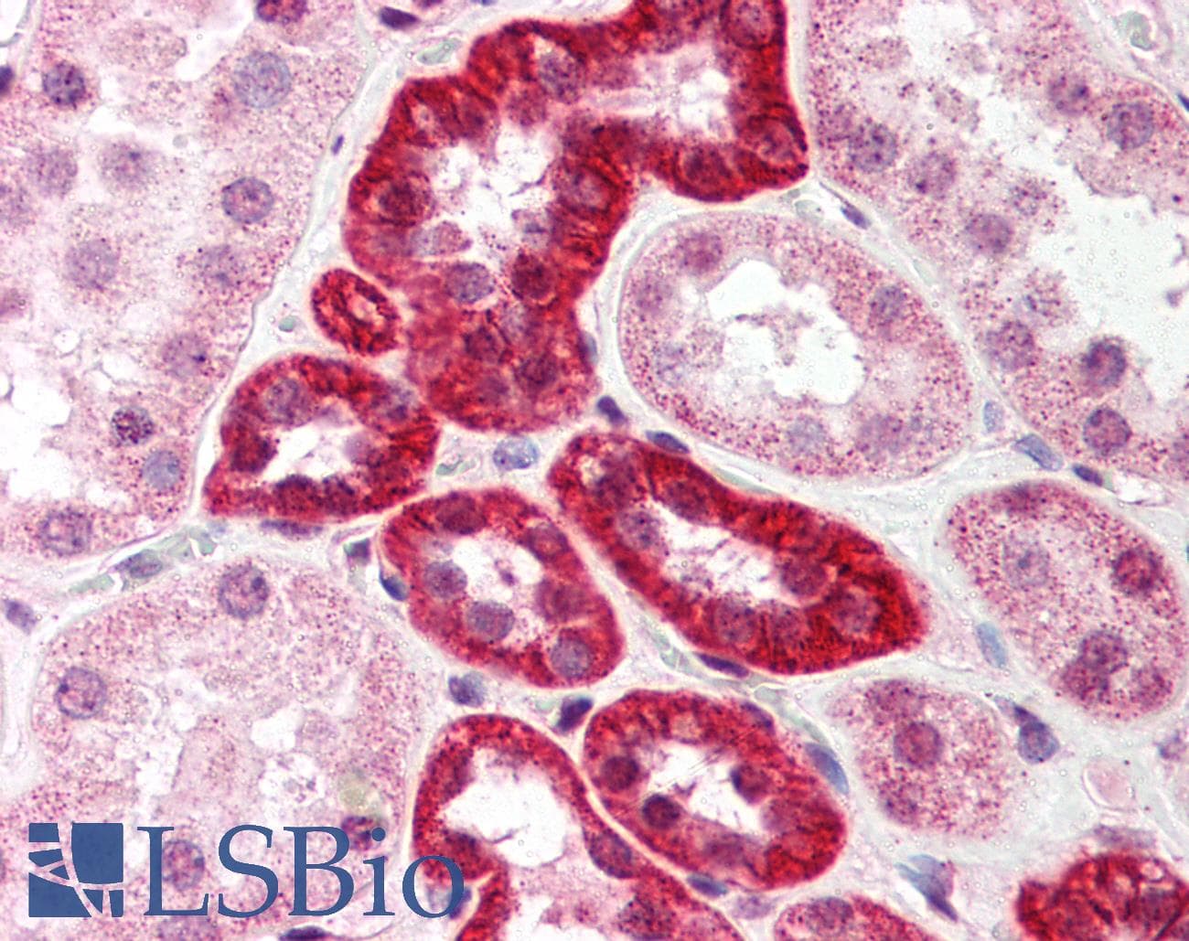 IHC-plus™ SUMO1 / SMT3 Antibody