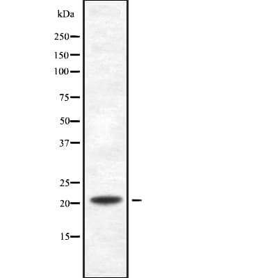 Polyclonal Rabbit anti-Human PDCD6 / ALG-2 Antibody (WB)