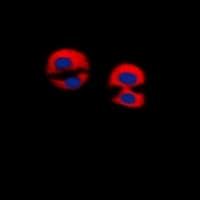 DMTN / Dematin Antibody (C-Terminus)