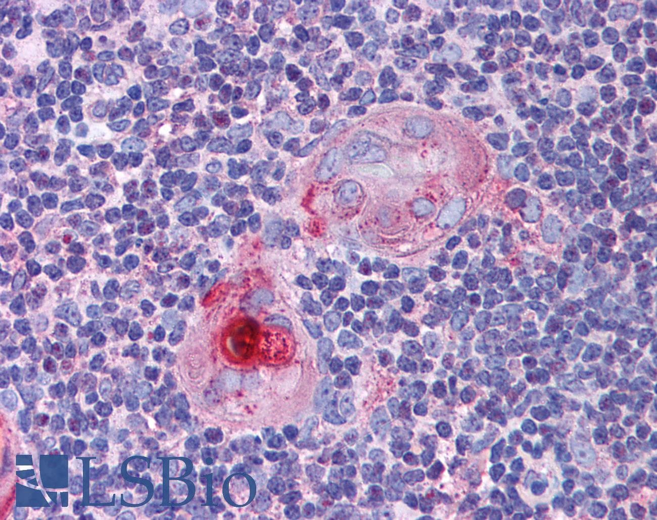 IHC-plus™ CASP8 / Caspase 8 Antibody (clone FLICE 4-1-20)