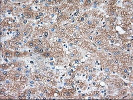 TS / Thromboxane Synthase Antibody (clone OTI2C1)