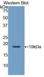 ANGPT1 / Angiopoietin-1 Antibody (Biotin)
