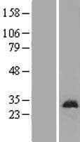 ATP5SL Protein (Over-Expression Lysate Myc-DDK (Flag))
