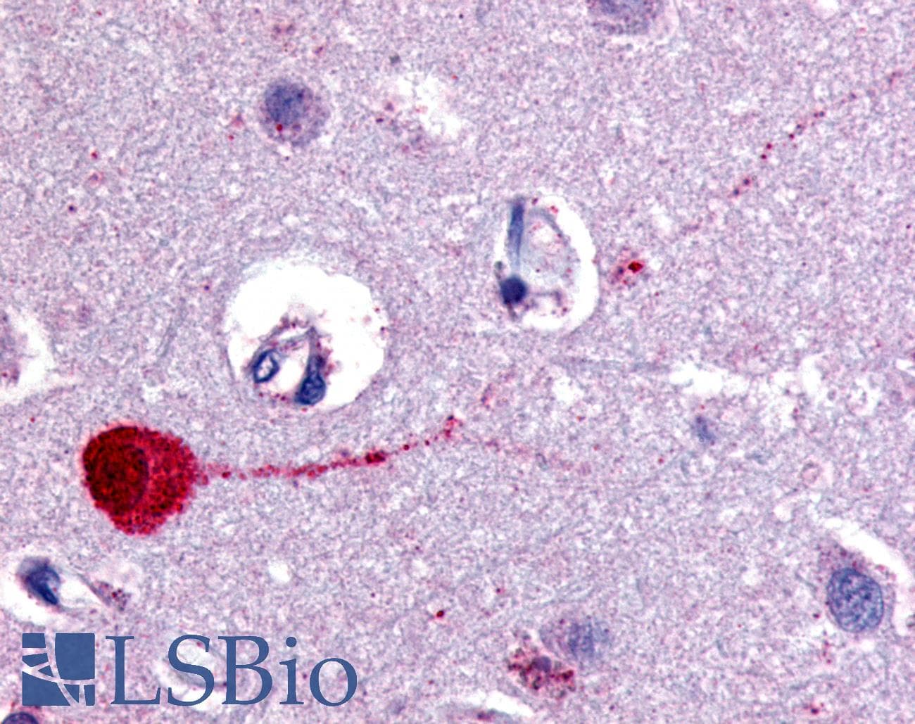 IHC-plus™ CHRM3 / M3 Antibody (Cytoplasmic Domain)