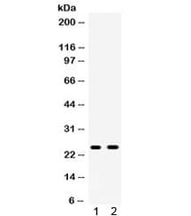 Polyclonal Rabbit anti-Rat APOA1 / Apolipoprotein A 1 Antibody (IHC, WB)