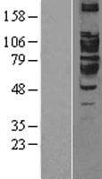 ARTS1 / ERAP1 Protein (Over-Expression Lysate Myc-DDK (Flag))