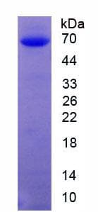 Human PRKG2 / CGKII Protein (Recombinant His-GST, N-terminus)